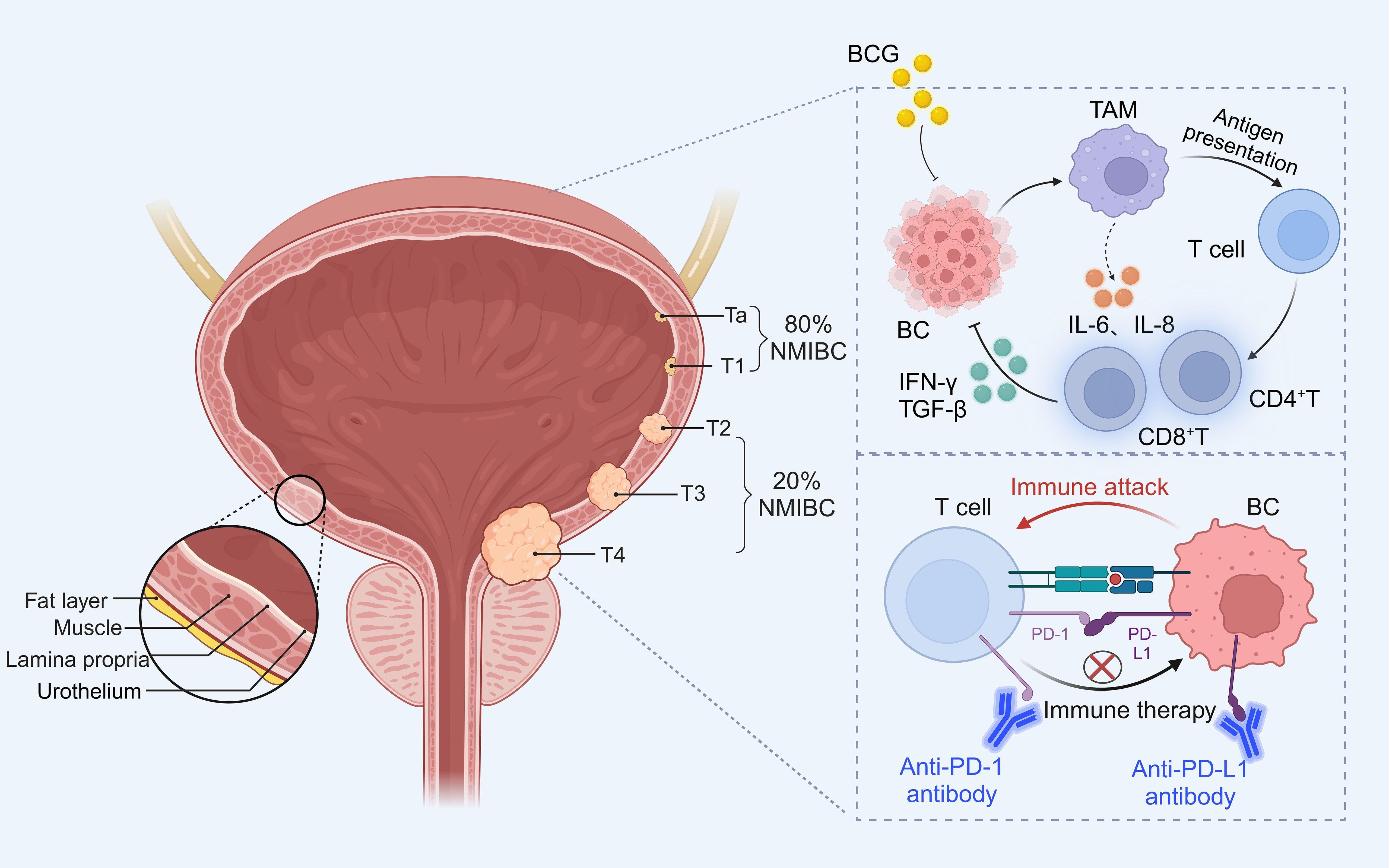 Current Status of Immunotherapy for Bladder Cancer: From BCG to Precision Combination Therapy