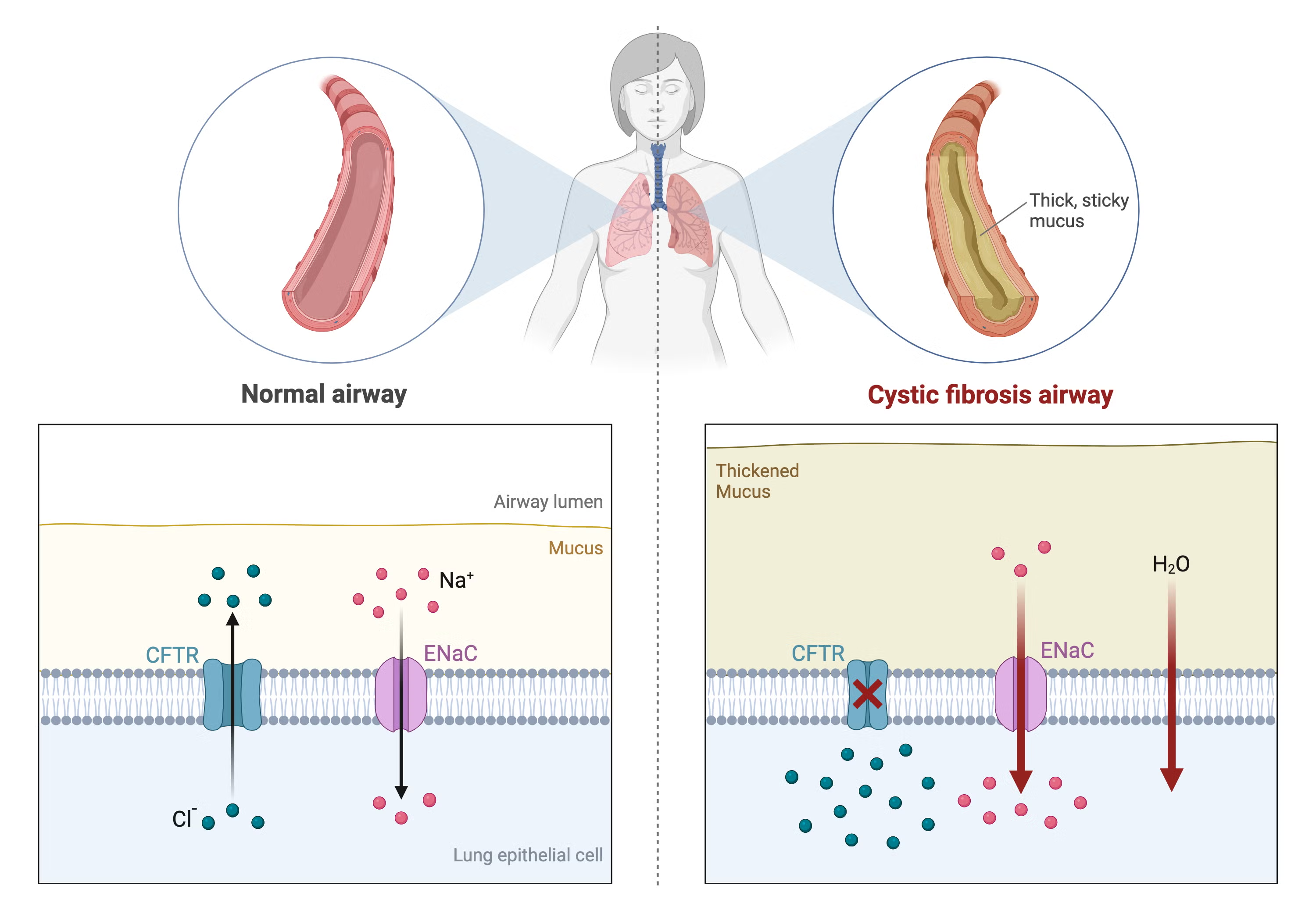 CFTR dysfunction and airway mucus thickening