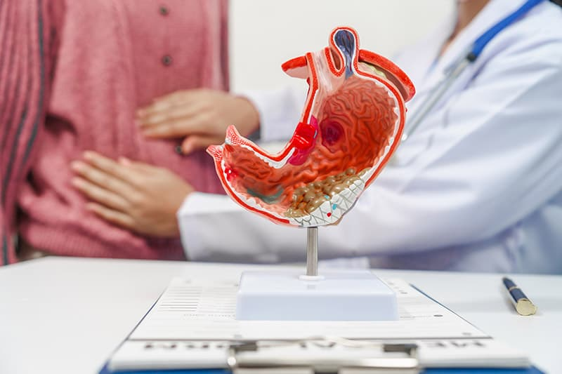 Gastric cancer anatomical model