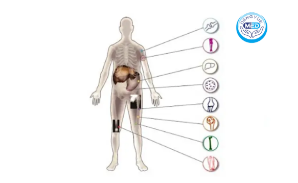 New Advances in Gaucher Disease Classification: Clinical Characteristics of Type I, Type II, Type III, and Rare Subtypes