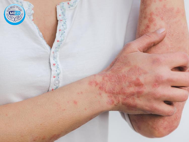 World’s First! In Vivo CAR-T Successfully Treats Systemic Lupus Erythematosus: A Revolutionary Breakthrough in Immune Reprogramming