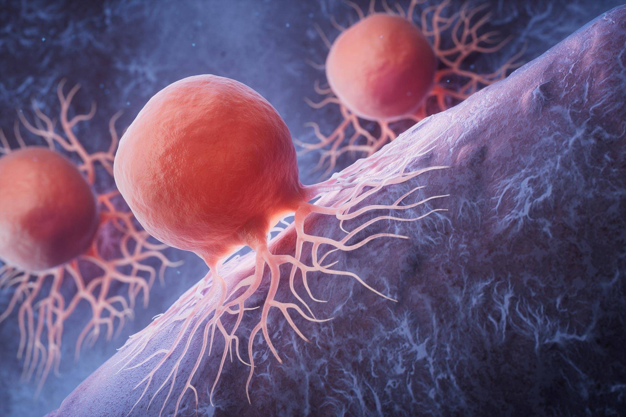 KRAS-Mutant Cancer Cell