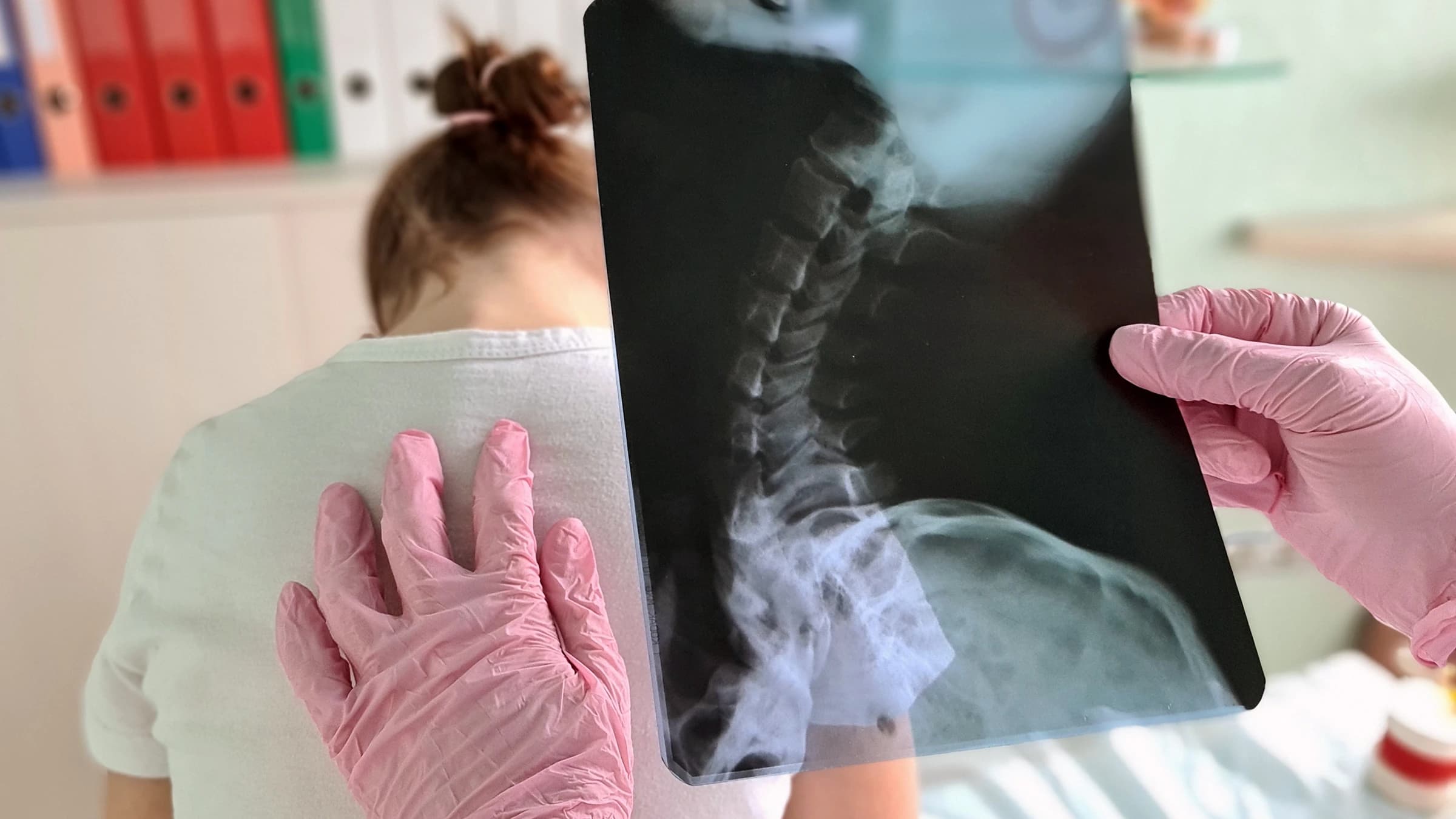Non-radiographic axial spondyloarthritis medical illustration