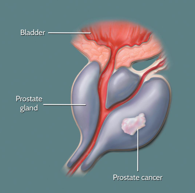 Oral Medications for Prostate Cancer: How Can Patients Achieve More Structured Home-Based Management?