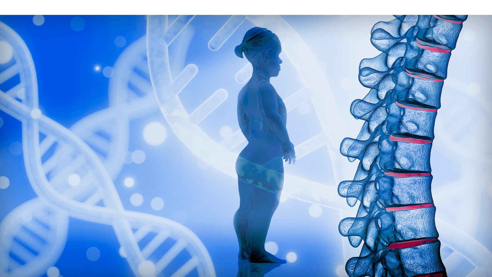 Skeletal disorder illustration