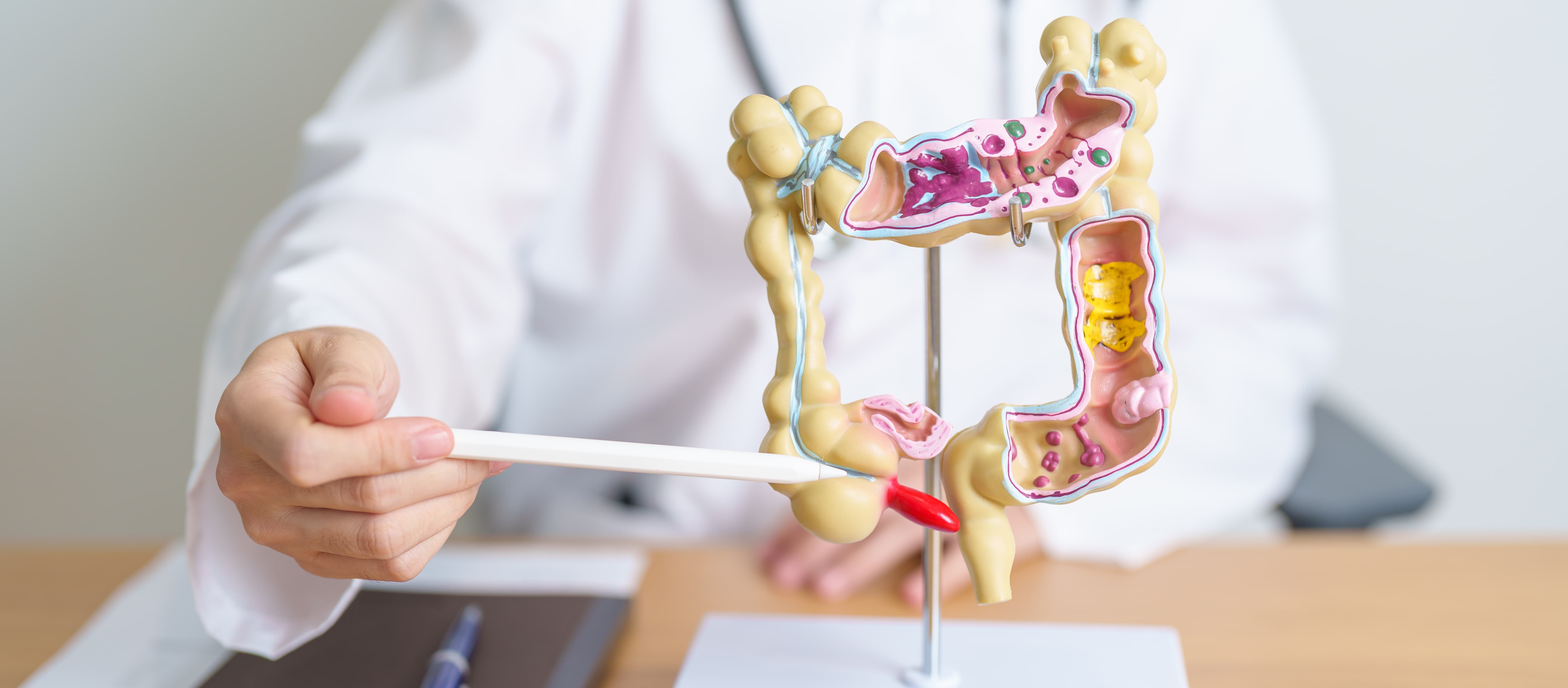 A New Breakthrough in Colorectal Cancer ADC Therapy: Trastuzumab Rezetecan Approved for HER2-Positive Colorectal Cancer in China