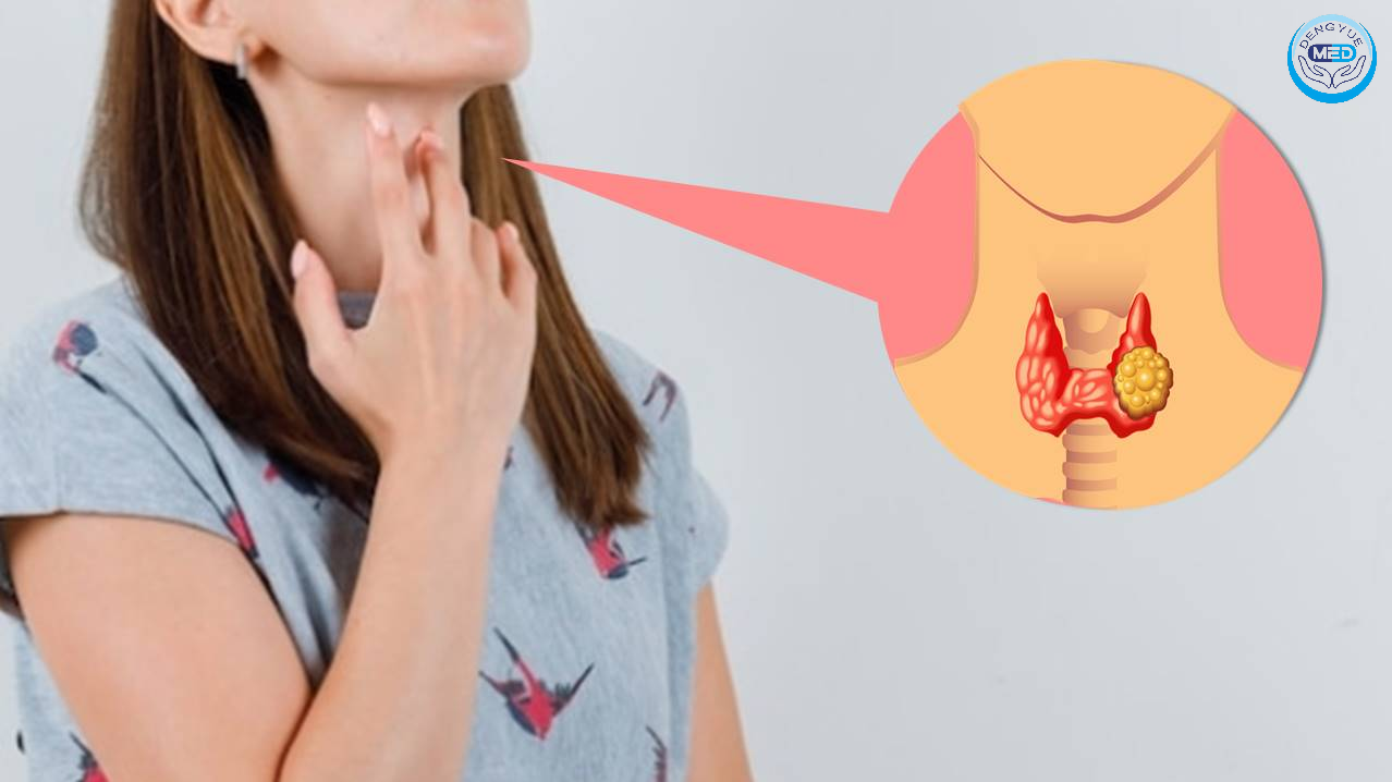 Are Women More Prone to Thyroid Cancer? Causes and Prevention Explained